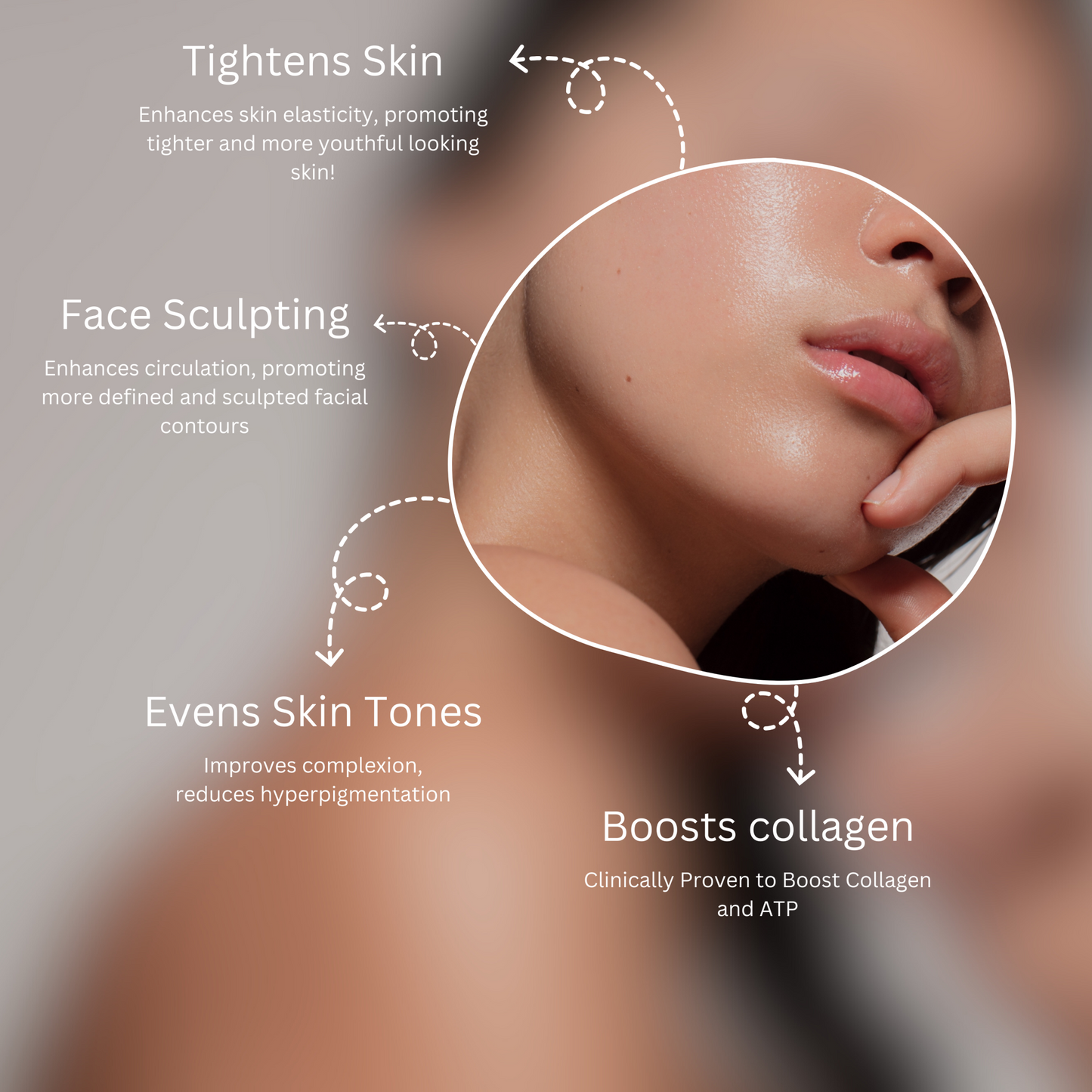 SULÉN Face Lifting Device